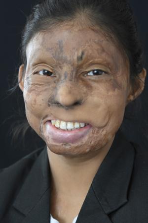 5-roopa